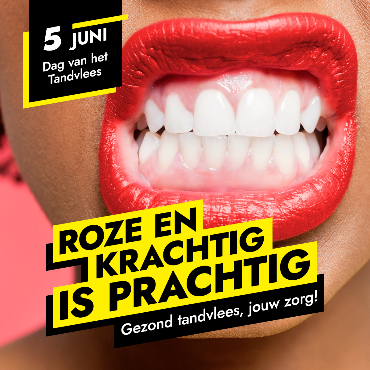 Dag van het tandvlees!